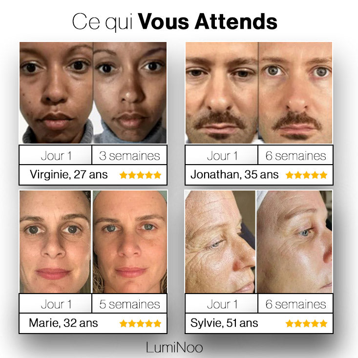LumiNoo™ Domptez vos hormones, sublimez votre peau